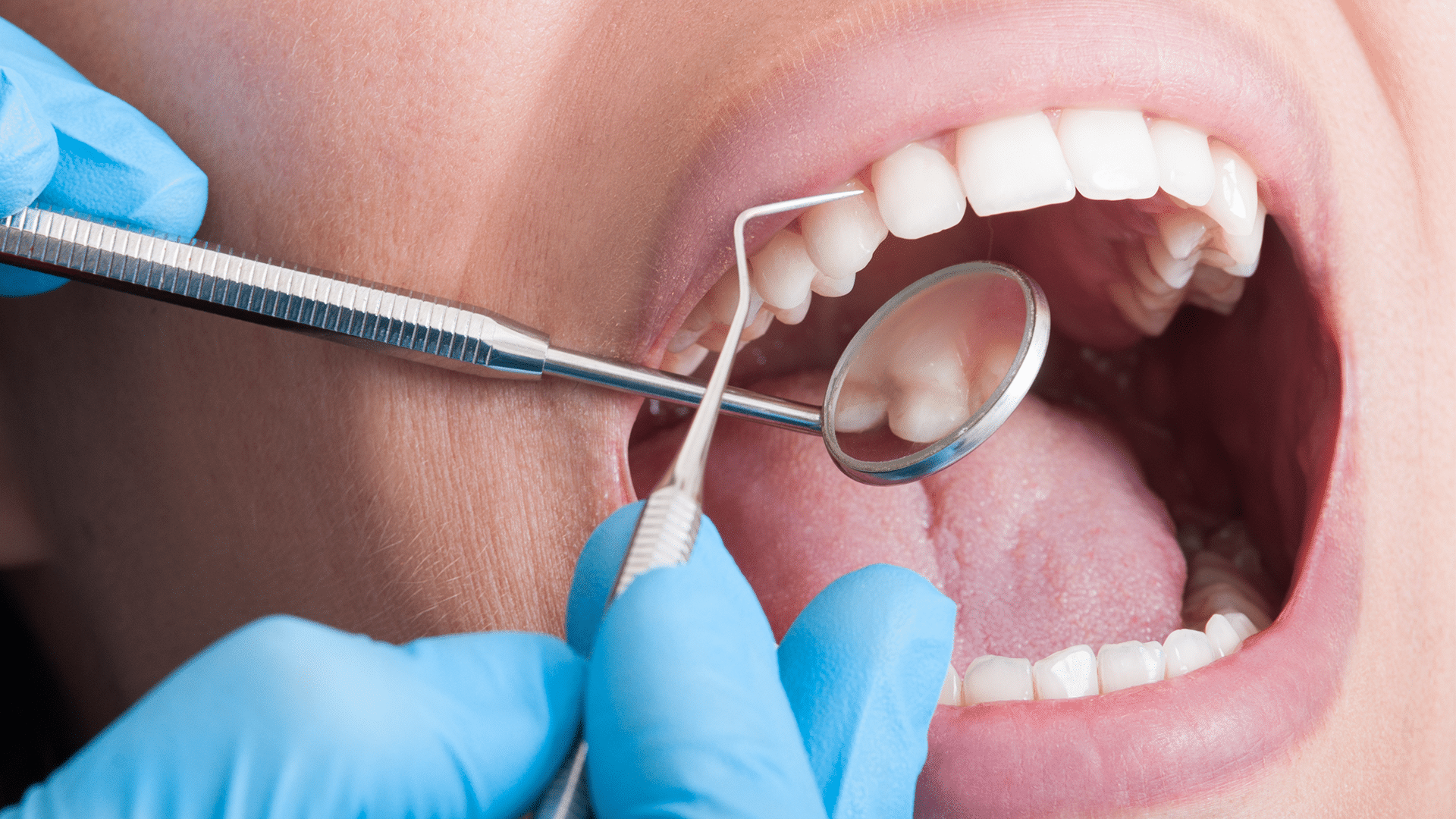 How Gentle Dental Care Can Transform Your Dental Visits