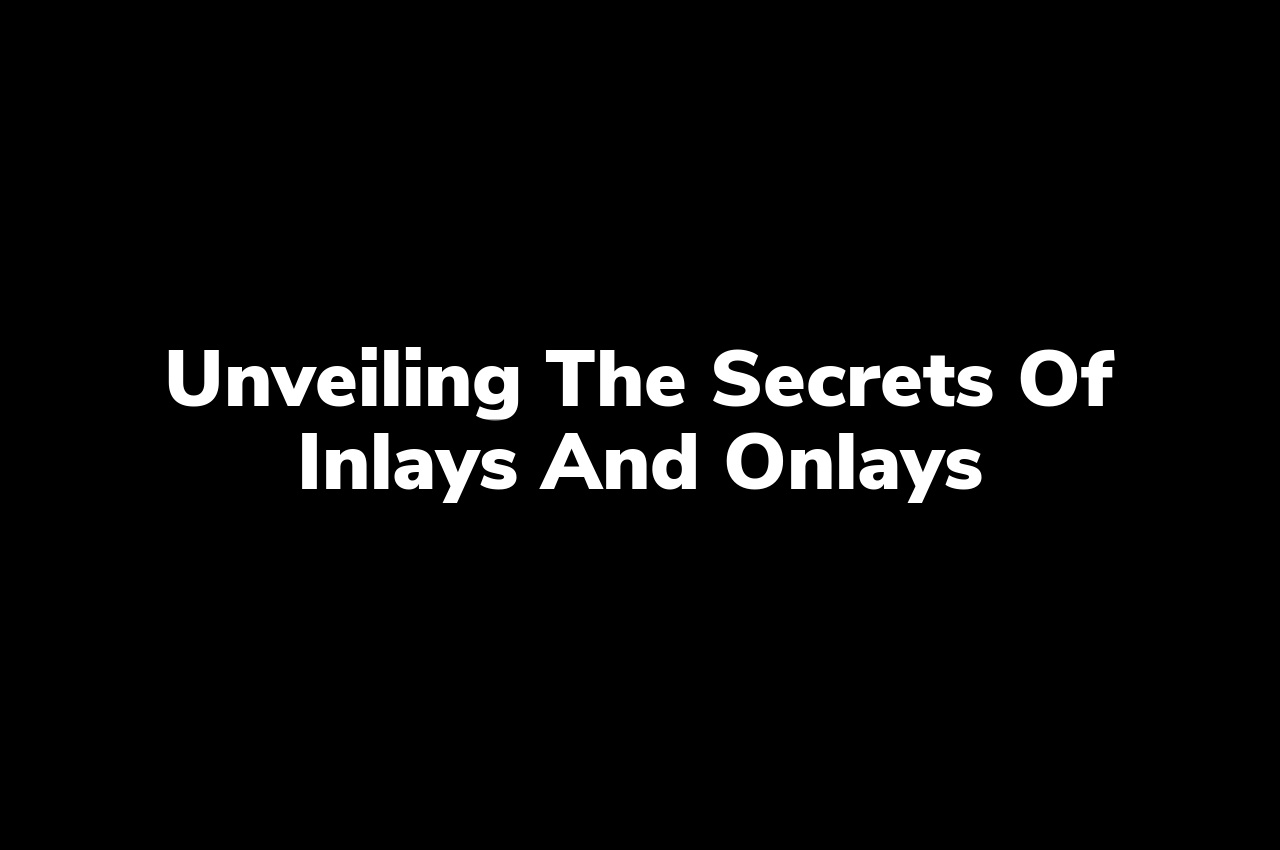 Unveiling the secrets of inlays and onlays